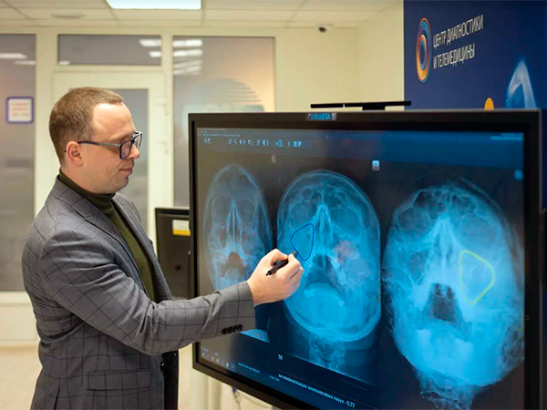 В Москве начато применение ИИ-системы диагностики заболеваний уха-горла-носа – департамент здравоохранения